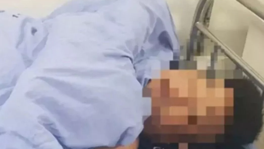 Le cortó el pene y los dos testículos a su pareja después de atraparlo abusando de su hija