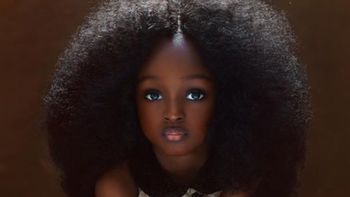 Así luce hoy Jare Ijalana, la niña que fue bautizada como la más bella del mundo
