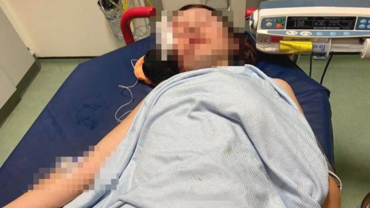 Golpearon a una nena con autismo hasta dejarla inconsciente
