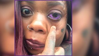 Una madre de cinco hijos se tatuó los globos oculares y ahora se está quedando ciega