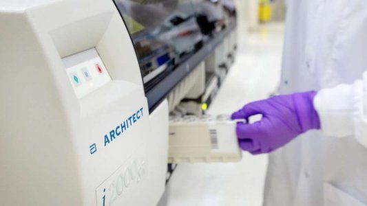 Coronavirus: nueva prueba de anticuerpos con una precisión del 99% fue aprobada para su uso en toda Europa