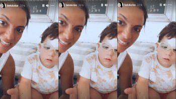 El accidente que sufrió uno de los hijos de Belu Lucius y que terminó con puntos de sutura