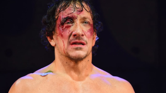 El duro golpe que enfrentó Nico Vázquez tras su separación de Gimena Accardi: Estoy dolorido...