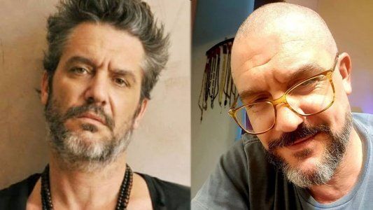 Maxi Ghione contó que se realizará a un operación que podría cambiarle la vida