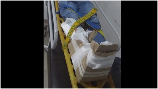 Un hombre llegó con una fractura expuesta a un hospital de Chaco y lo enyesaron con cartones
