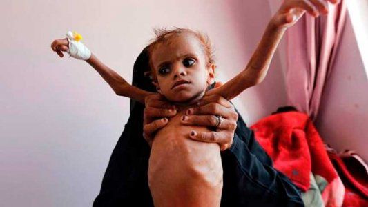 Por la guerra en Yemen murieron de hambre 85 mil niños en los últimos 3 años