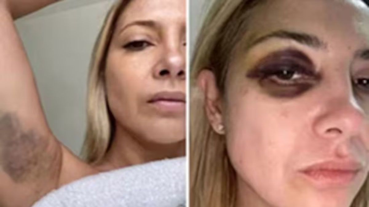 Las fotos de Fabiola Yañez, que dieron la vuelta al mundo. (Foto: Gentileza El Universal)