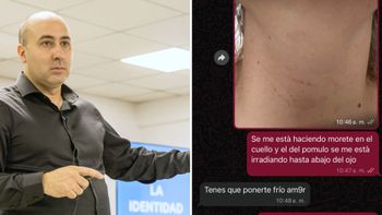 Se me está haciendo un morete...: los chats entre el ex asesor de Milei y su ex pareja antes del ataque a tiros