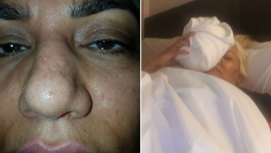 Fuerte golpe en la nariz y reposo para Gladys La Bomba Tucumana