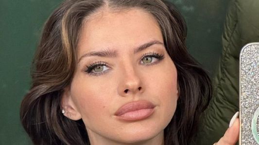 La China Suárez confesó qué cirugía estética se hizo y dio una llamativa explicación en un video