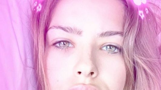 Dicen que la China Suárez se puso bótox en los labios