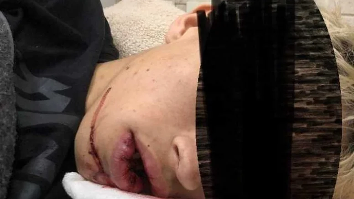 El joven está internado en un hospital local. (Foto: gentileza Luján Hoy)