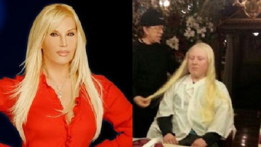 Se terminó el misterio: un hombre albino le da su cabello a Susana