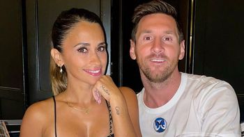 Antonela Roccuzzo se hizo un tratamiento estético en el rostro y deslumbró a todos con el resultado