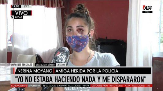 Habló la amiga de Úrsula herida en la protesta: Mi ojo es lo de menos, pero lo que le hicieron a ella no se puede explicar