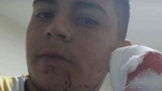 Tucumán: atacaron a un cadete y le cortaron cuatro dedos