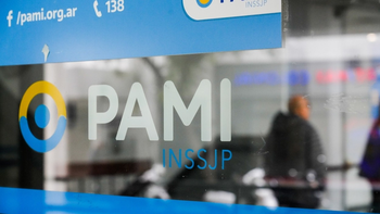 PAMI negó sobreprecios en la compra de lentes intraoculares