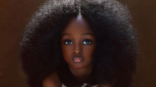 Así luce hoy Jare Ijalana, la niña que fue bautizada como la más bella del mundo