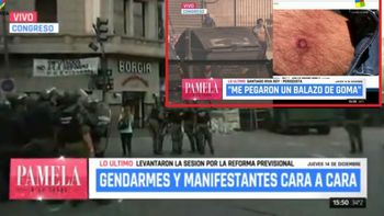 Santiago Riva Roy recibió un disparo de bala de goma mientras salía al aire