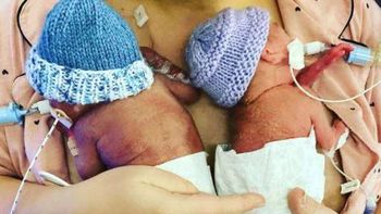 El milagro de los bebés más prematuros del mundo: Nacieron a la 22 semanas