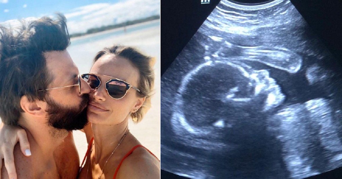 La primera imagen de Capri, la hija del Rifle Varela y Pía Marcollese