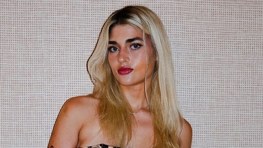 Marta Fort reveló el problema neurológico que padece desde su nacimiento