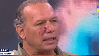 Sergio Berni explicó: No estoy convencido de que el detenido sea el asesino. (Foto: captura de video) Sergio Berni explicó: No estoy convencido de que el detenido sea el asesino. (Foto: captura de video)