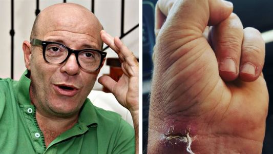 Campi: Me corté con la agujereadora arreglando la cama de la nena