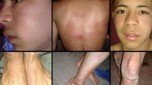 Tirón de orejas para el Gobierno: la justicia cuestionó a las fuerzas de seguridad por dos casos de abuso policial