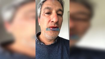 La grúa le llevó el auto, fue a reclamar y lo molieron a palos: Vinieron dos tipos y me cagaron a trompadas