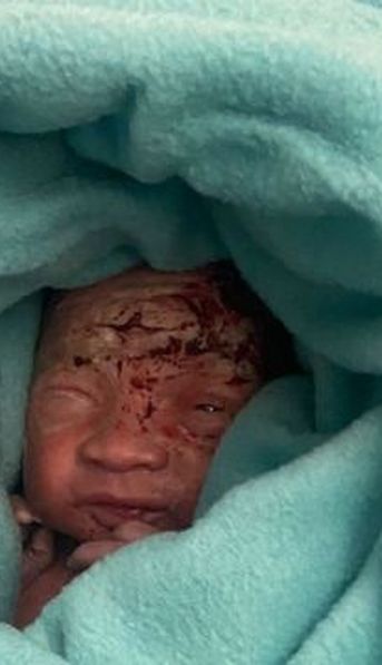 Rescatan a un recién nacido de un pozo ciego: detuvieron a su madre