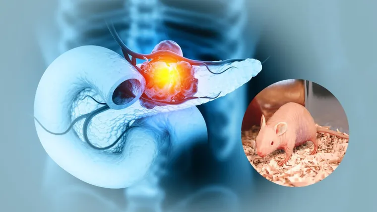 Un equipo de científicos logró resultados alentadores con una terapia experimental contra el cáncer de páncreas.