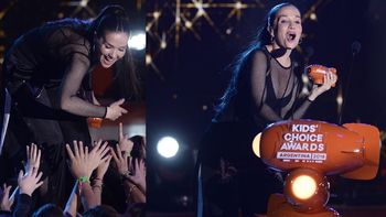 La bronca de Oreiro: Fui a un cirujano plástico para que me reacomodara la cara, me hicieron cuatro puntos