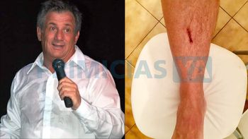 La defensa de Torry luego de la agresión al Mago sin Dientes: Me pegó un puntapié en la canilla