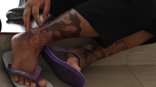 Voces silenciadas, abusos desenmascarados: el caso de la empleada doméstica y al excremento