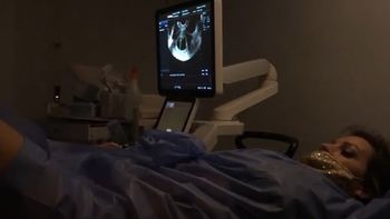 Noelia Marzol y su divertida reacción en su primera ecografía de embarazo: Está re alterado