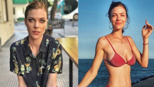 Laura Laprida confesó que padece un cáncer de piel