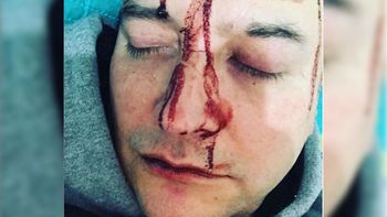 leo garcia denuncio una brutal agresion y publico fuertes videos leo garcia denuncio una brutal agresion y publico fuertes videos