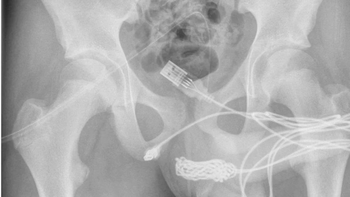 tenia un cable usb en el pene: la increible explicacion que dio un joven de 15 anos tenia un cable usb en el pene: la increible explicacion que dio un joven de 15 anos