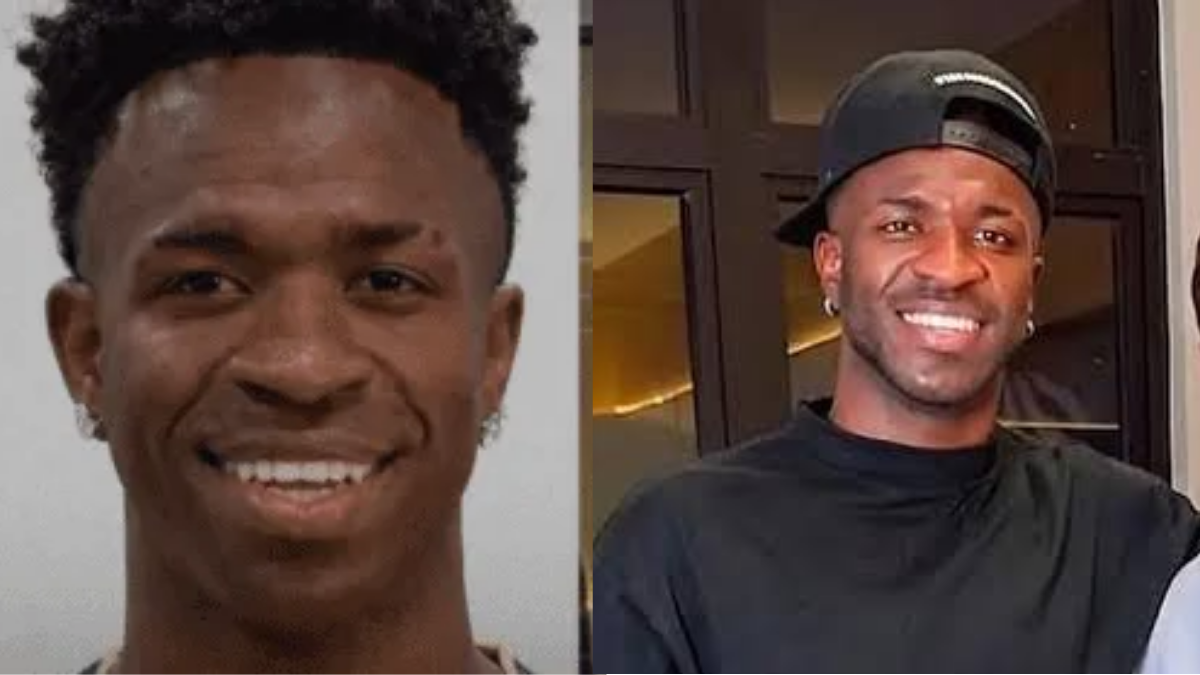 Cambio radical: los detalles sobre la cirugía estética de Vinícius Jr. que sorprende a todos