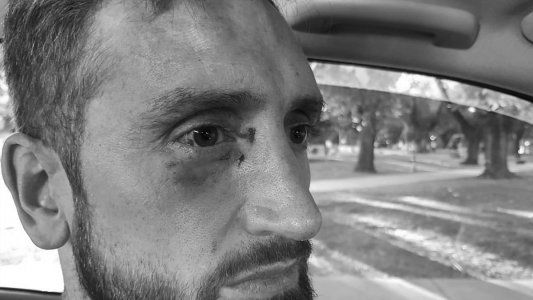 Hinchas de Peñarol de Mar del Plata atacaron a Alejandro Reinick, basquetbolista de Quilmes