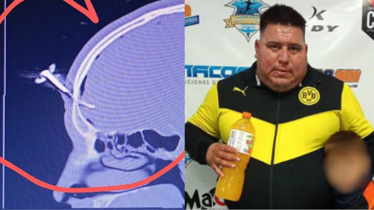 Quién es el hombre que le clavó una llave en la cabeza a un padre después de un partido de fútbol juvenil