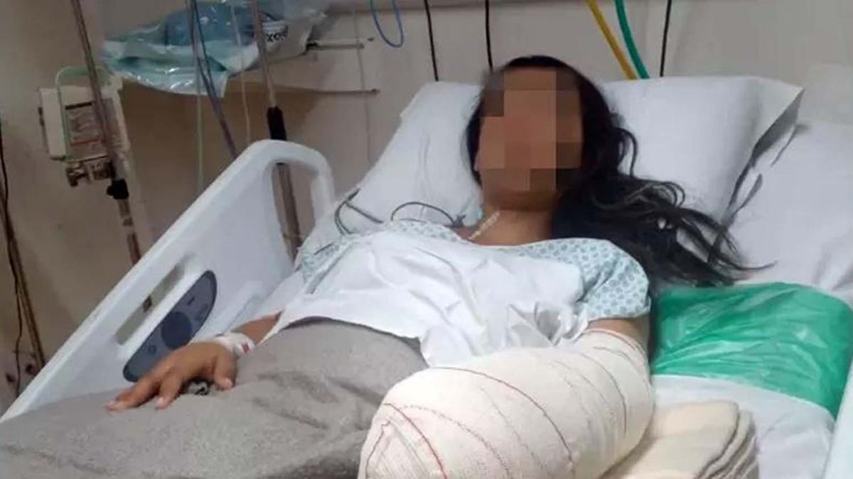 Una mujer fue al hospital para dar a luz y salió con una mano amputada
