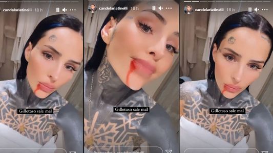 El accidente doméstico de Cande Tinelli por el que terminó ensangrentada