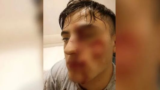 Vio a un joven con su exnovia en un boliche de Hurlingham y le cortó la cara con una copa: Me cegué