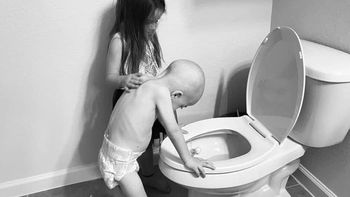 Niño con cáncer cuya foto se volvió viral se ha recuperado