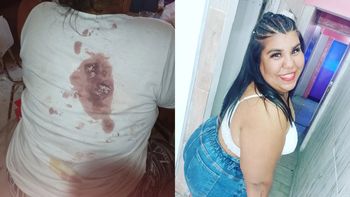 La hermana de Thiago de Gran Hermano 2022 mostró todas las fotos de cómo quedó tras el brutal ataque