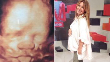 Florencia Peña y una llamativa ecografía: Felipe ya es rolinga