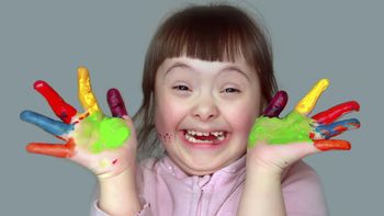 En el Día Mundial del Síndrome de Down: las claves para entenderlo desde un abordaje integral