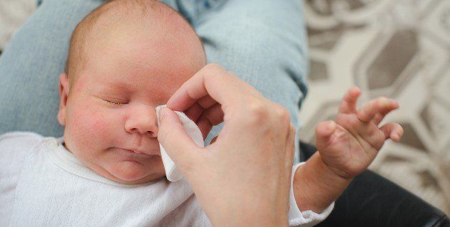 Conjuntivitis en bebés: lo que hay que saber
